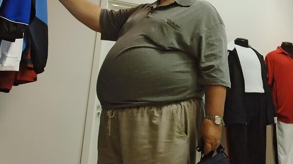 obez - Sputnik Türkiye