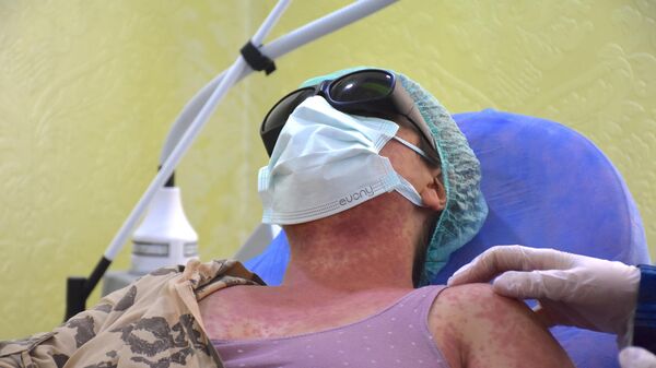 Kezzap etkisi yaratan krem 4 kişiyi hastanelik etti: İnternette 'leke giderici' diye satıldı - Sputnik Türkiye