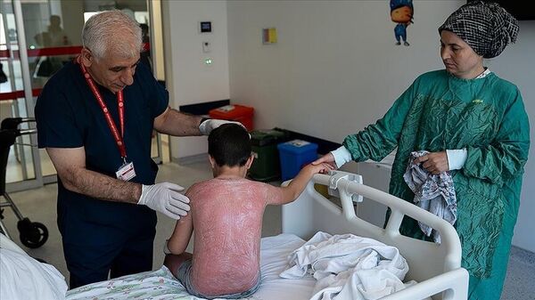 Güneş yanığı - Sputnik Türkiye