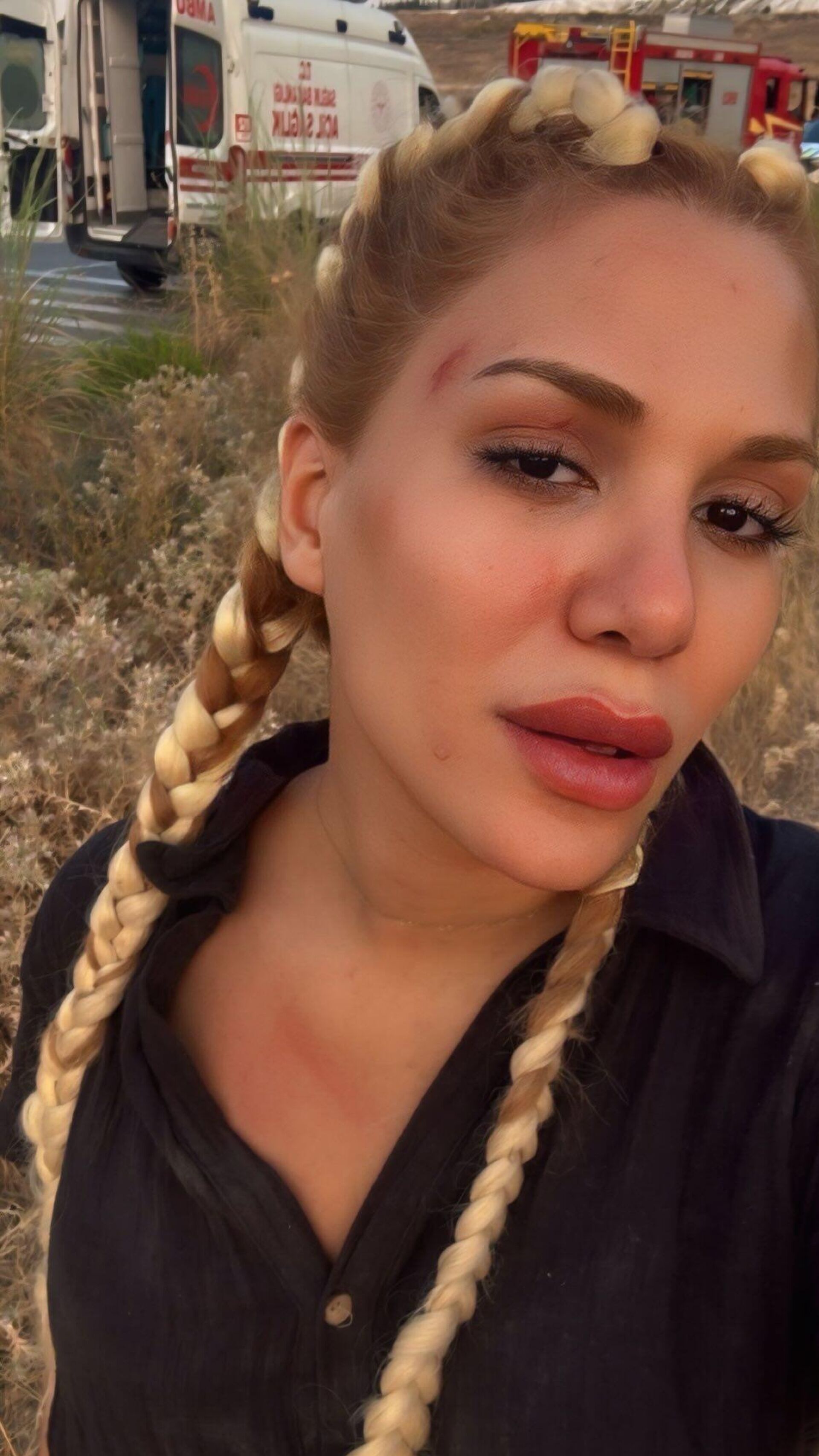 Survivor Almeda sosyal medya  - Sputnik Türkiye, 1920, 18.08.2025