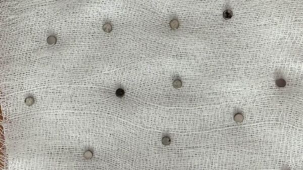 Elazığ'da 3 yaşındaki çocuğun yuttuğu ve yemek borusunu tıkayan 19 mıknatıs operasyonla çıkarıldı - Sputnik Türkiye