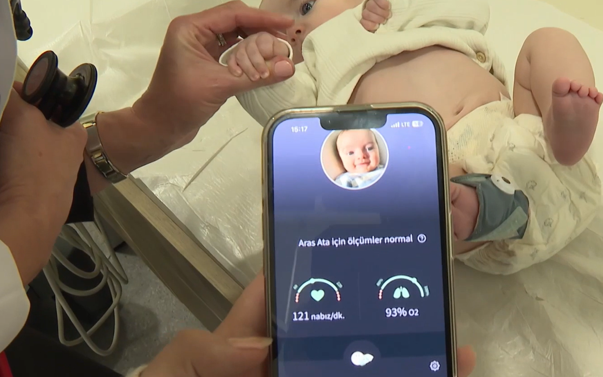 akıllı çorap cihazı - Sputnik Türkiye, 1920, 01.11.2025