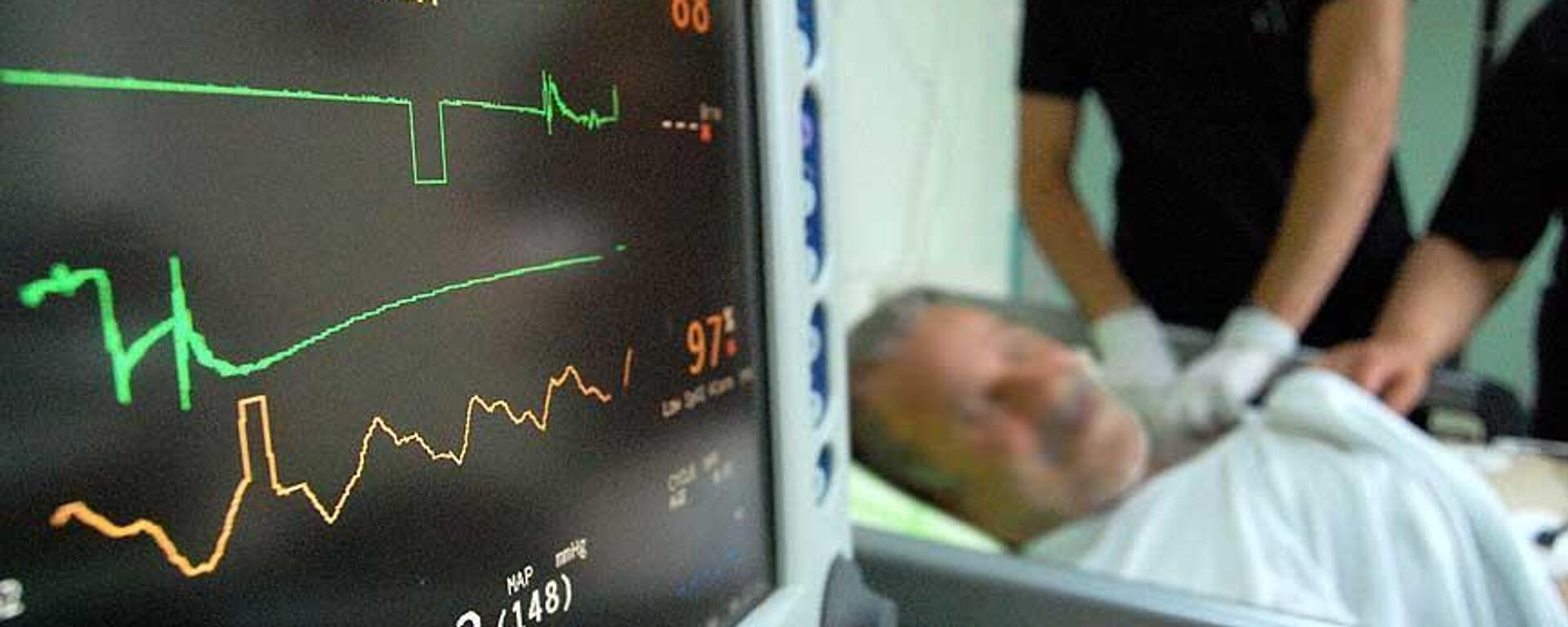 Şok cihazı - Sputnik Türkiye, 1920, 02.12.2025