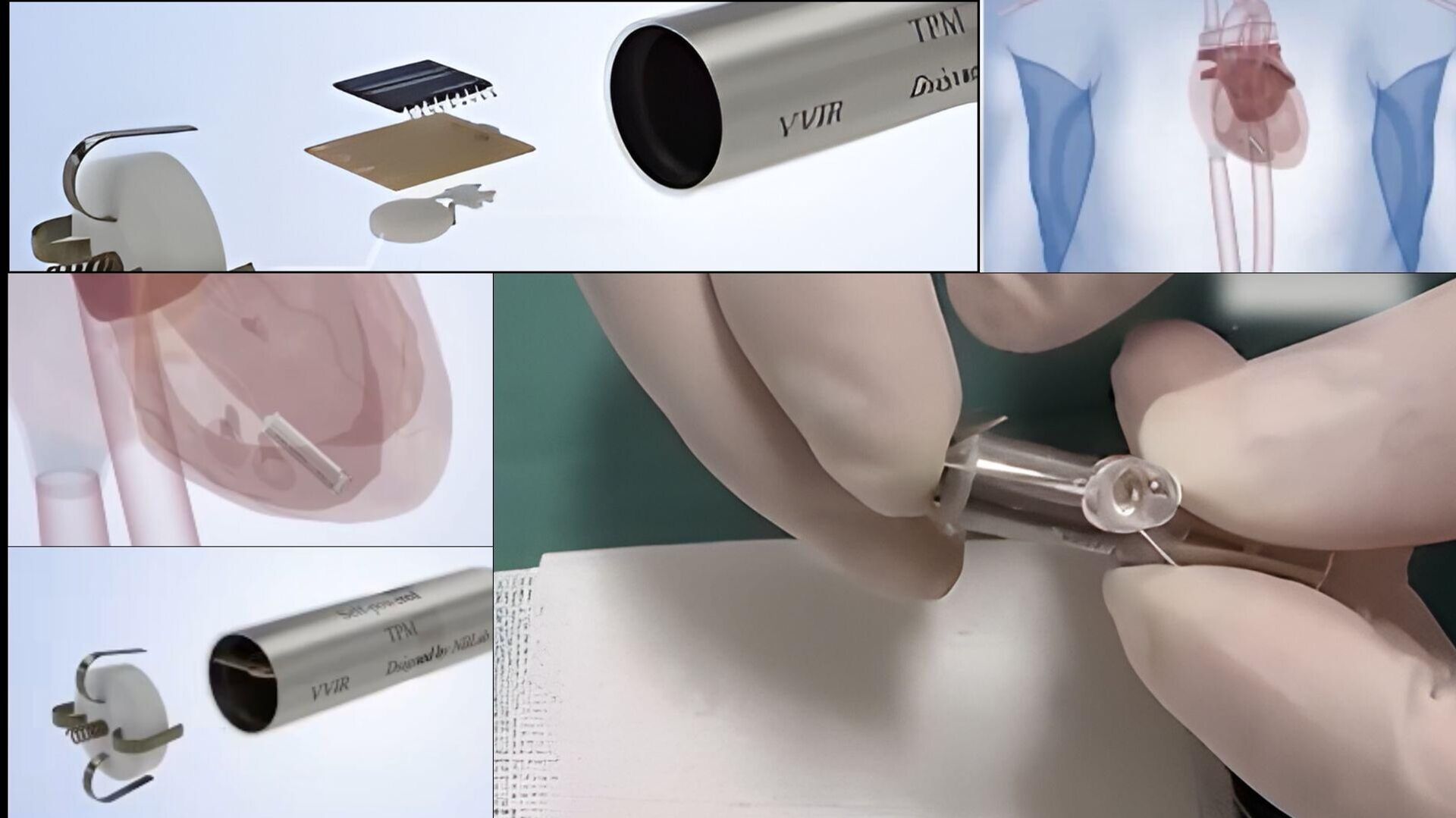 Çin'de üretilen kalp pili - Sputnik Türkiye, 1920, 26.01.2026