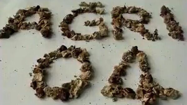 Ağrı'da bir hastadan çıkarılan böbrek taşlarıyla 'Ağrı 04' yazıldı - Sputnik Türkiye