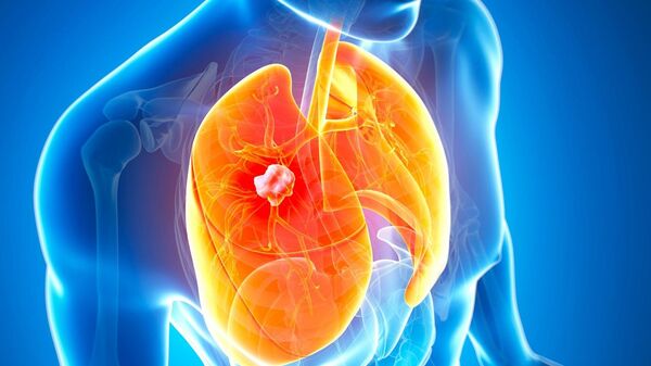 Akciğer (Temsili Görsel) - Sputnik Türkiye