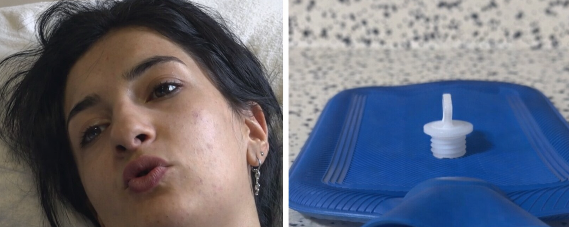 Sıcak su torbası patladı - Sputnik Türkiye, 1920, 08.02.2026