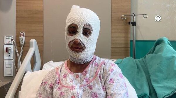 İftar vakti düdüklü tencere patladı: Yüzünde 2'nci derece yanıklar oluştu - Sputnik Türkiye