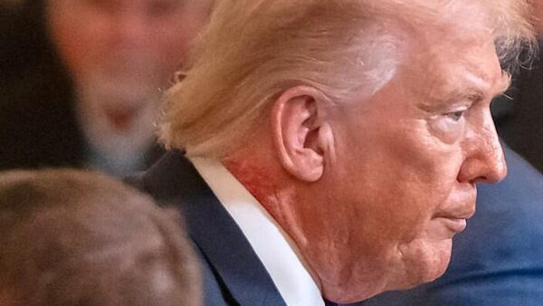 Donald Trump'ın boynundaki kırmızı leke - Sputnik Türkiye