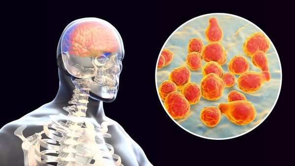 Menenjit - Sputnik Türkiye