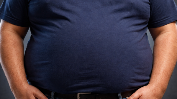 Obezite - Sputnik Türkiye