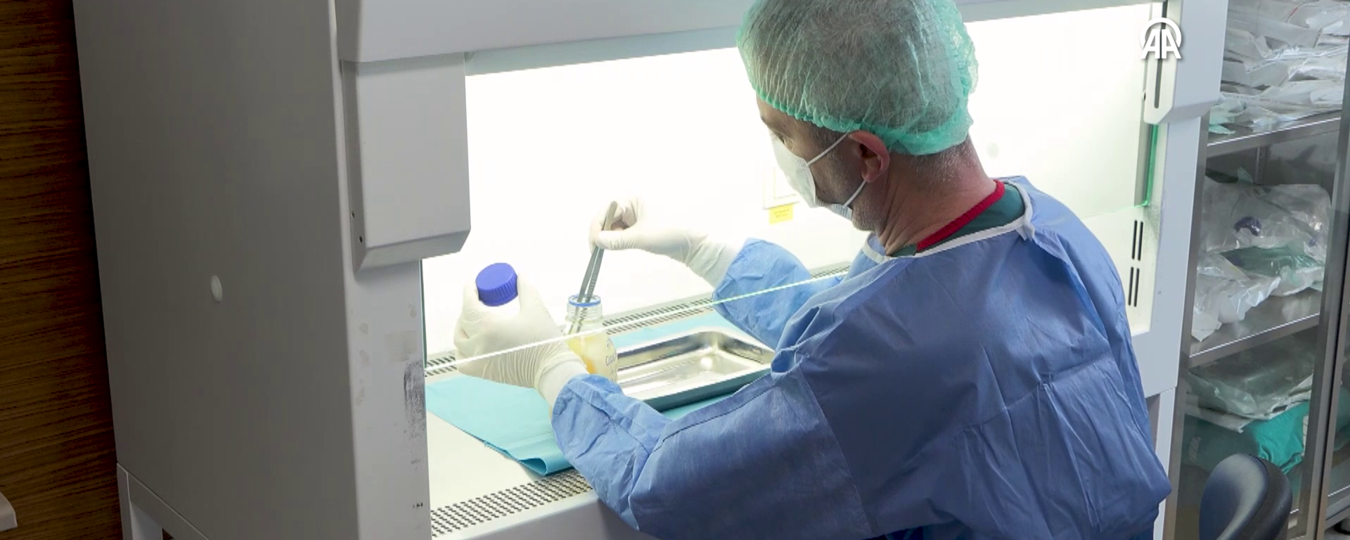 deri nakli  - Sputnik Türkiye, 1920, 06.04.2026