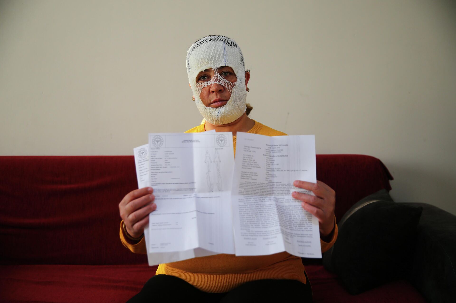  'Prenses bakım' yaptırdı yüzü yandı - Sputnik Türkiye, 1920, 22.04.2026