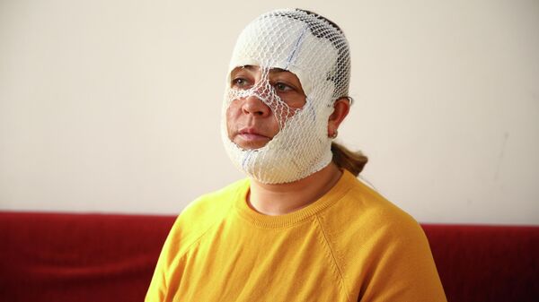  'Prenses bakım' yaptırdı yüzü yandı - Sputnik Türkiye