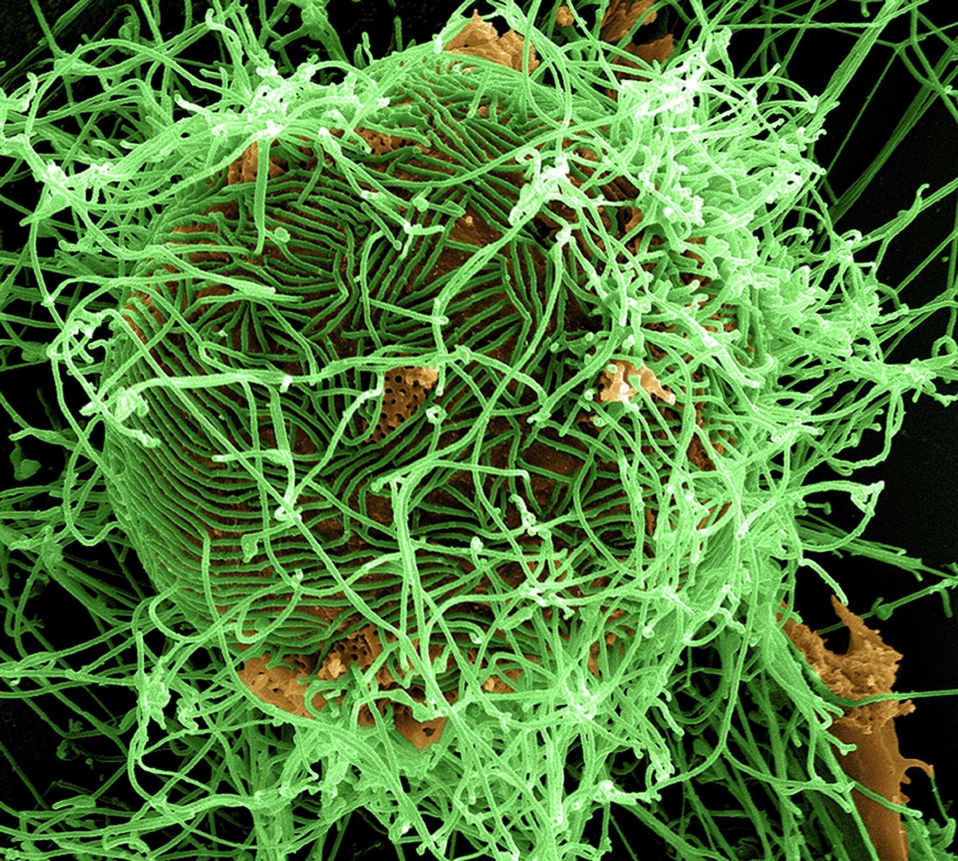 Ebola - Sputnik Türkiye, 1920, 18.05.2026