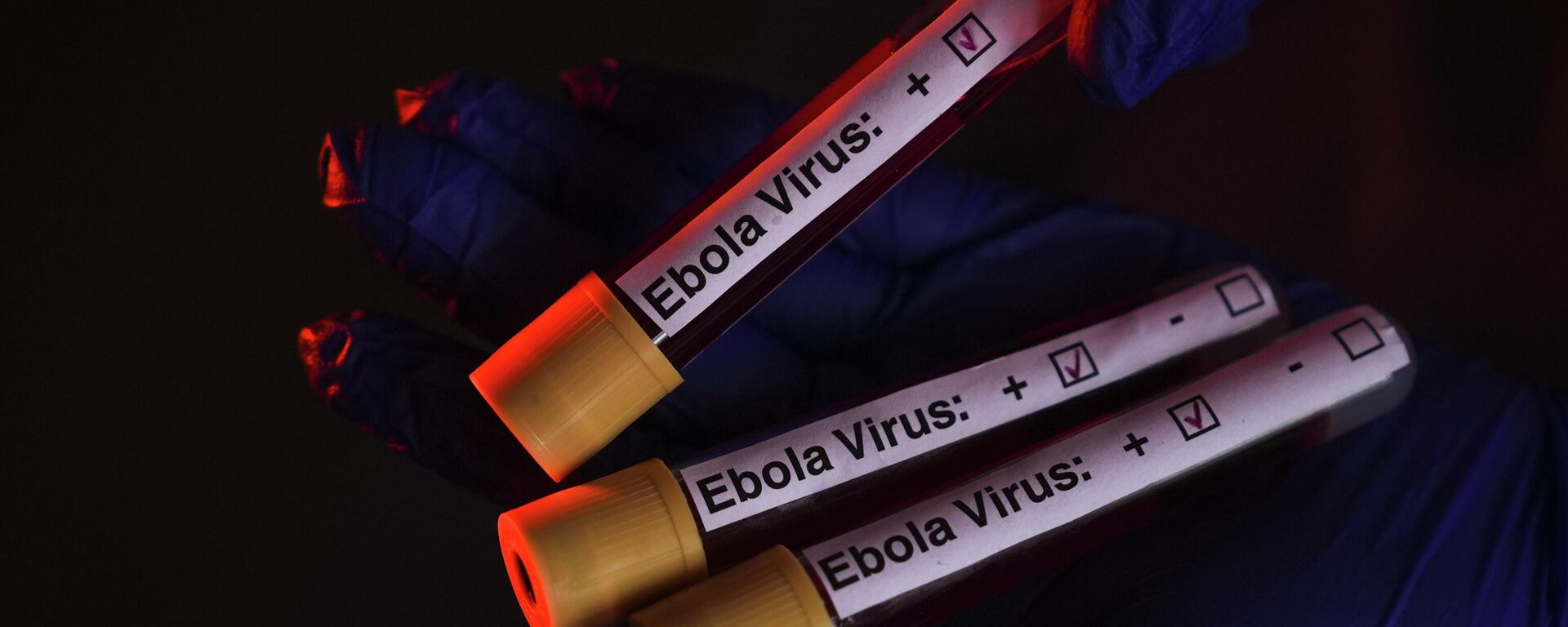 Ebola - Sputnik Türkiye, 1920, 25.05.2026