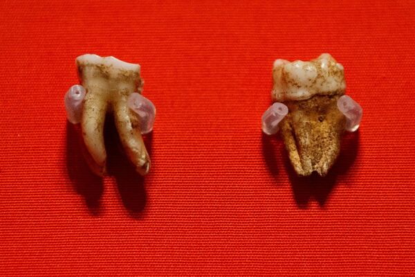 İngiltere Kralı John'un dişleri İngiltere Kralı John'un dişleri - Sputnik Türkiye