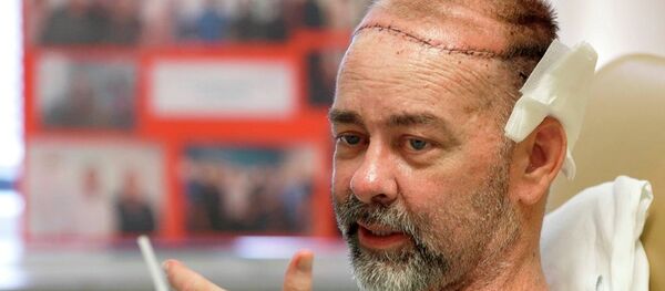 ABD'de dünyanın ilk kafatası nakli yapıldı ABD'de dünyanın ilk kafatası nakli yapıldı - Sputnik Türkiye