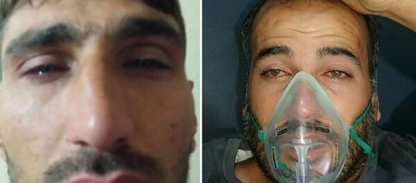 IŞİD, ÖSO'ya karşı kimyasal silah kullandı - Sputnik Türkiye