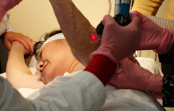 Doktor Jill Waibel, tedavi sayesinde Phuc’un sol kolu ve sırtını kaplayan yanık izlerini silip acılarını hafifletmeyi umduklarını söyledi. - Sputnik Türkiye