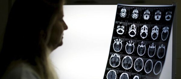 röntgen, beyin - Sputnik Türkiye