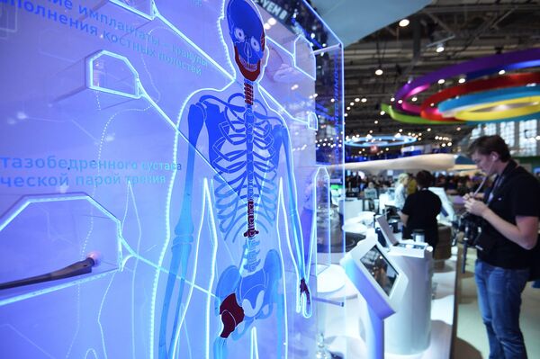 Yapay eklemlerin sergilendiği bir stant - Sputnik Türkiye
