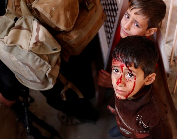 Musul’daki çatışmalar sırasında yaralanan bir çocuk. - Sputnik Türkiye