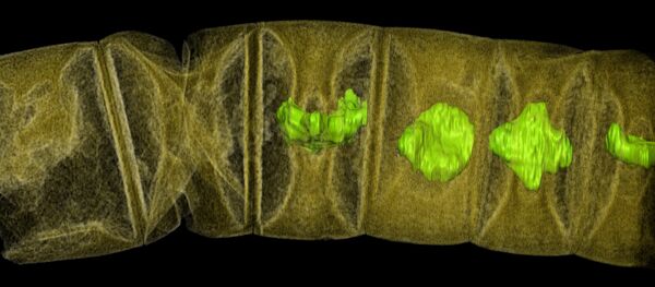 Hindistan'da bulunan fosillerin X-Ray görüntüsü - Sputnik Türkiye