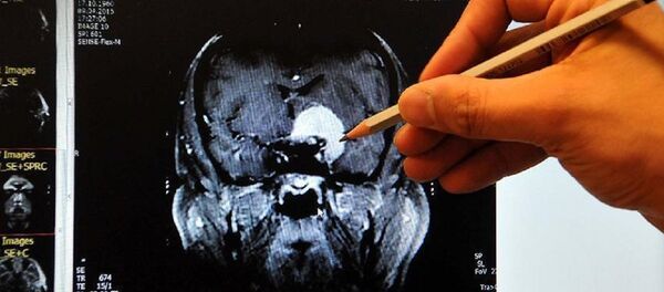 Kadın beyni, erkek beyninden daha aktif çalışıyor - Sputnik Türkiye