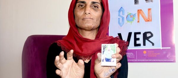 Eşinden şiddet gören Gülfidan Sepil - Sputnik Türkiye