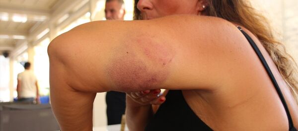 Bodrum'da caretta caretta saldırısı - Sputnik Türkiye