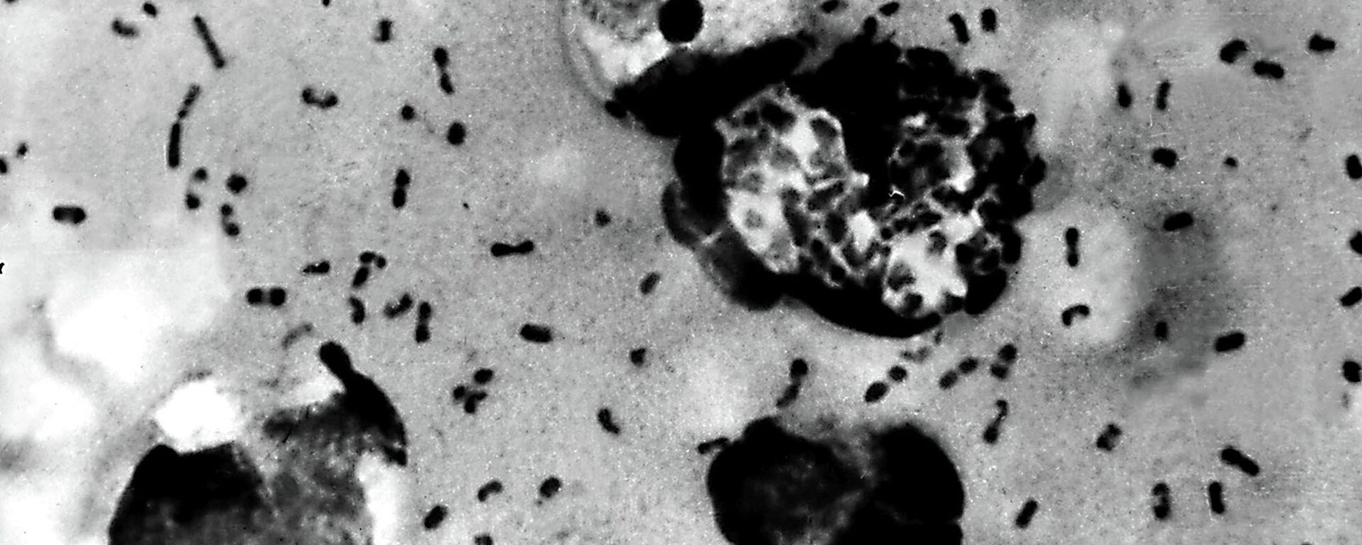 Veba bakterisi - Sputnik Türkiye, 1920, 02.06.2023