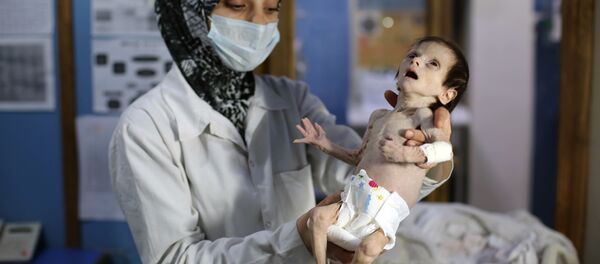 Şam'ın Doğu Guta bölgesindeki bir sağlık merkezinde, yetersiz beslenmekten dolayı gözetim altında tutulan bir bebek - Sputnik Türkiye