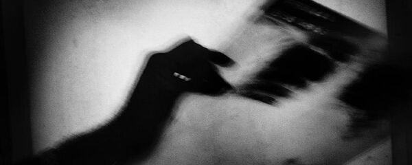 Doktor, röntgen - Sputnik Türkiye