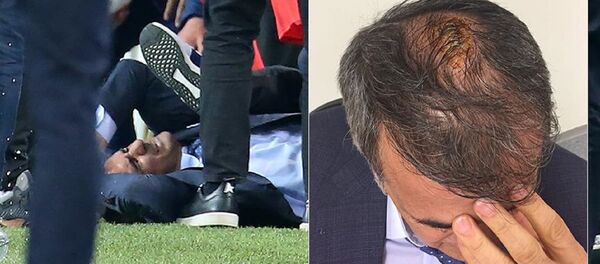 Fenerbahçe-Beşiktaş derbisinde Şenol Güneş yaralandı - Sputnik Türkiye