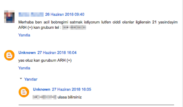 Satılık böbrek ilanı - Sputnik Türkiye