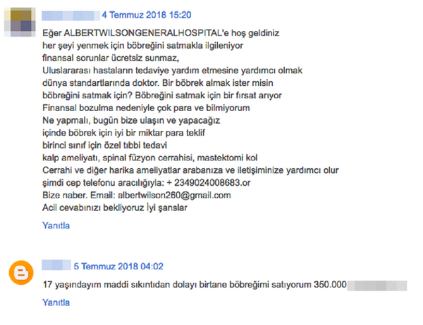 Satılık böbrek ilanı - Sputnik Türkiye