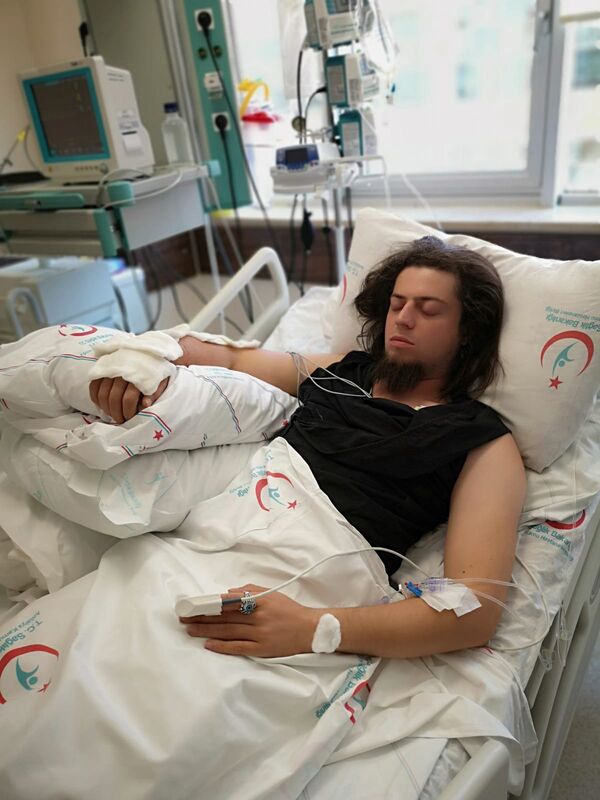 Kobra yılanı tarafından ısırılan Aref Ghafouri.  - Sputnik Türkiye