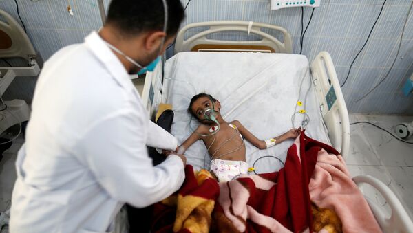 Yemen'de tedavi gören bir çocuk - Sputnik Türkiye