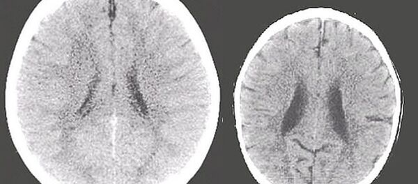 araştırma- beyin araştırma- beyin - Sputnik Türkiye