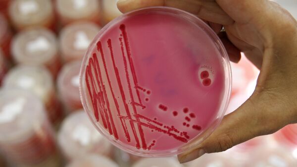 An analytical chemist shows a petri dish with salmonella in the Institute for Chemical and Veterinary Research in Stuttgart, southwestern Germany - Sputnik Türkiye