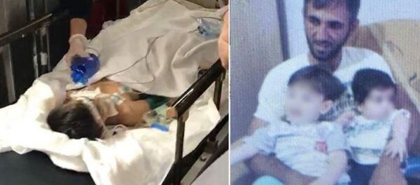 Hatay'ın İskenderun ilçesinde babası Mehmet Ali Y. tarafından dövülerek ağır yaralanan Mertcan Y., (6) - Sputnik Türkiye
