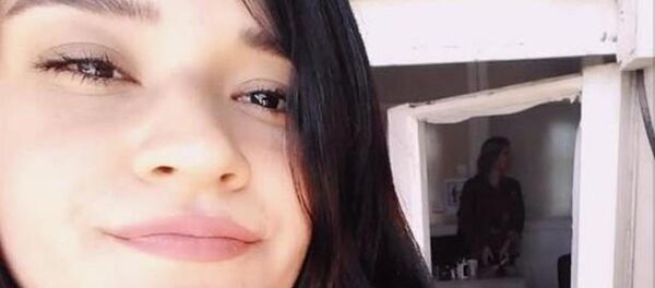 gaspçı tarafından telefonunu çalınmak istenirken yüzüne asit benzeri kimyasal sıvı atılan Berfin Özek - Sputnik Türkiye