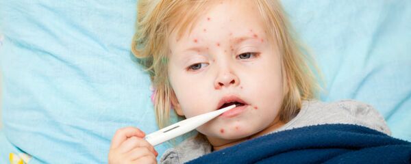 kızamık - Sputnik Türkiye