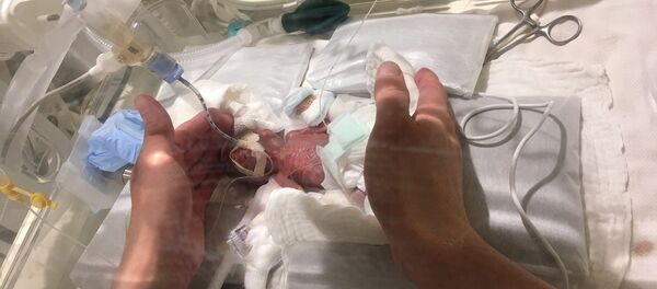 Japonya'da 268 gram ağırlığında doğan bir erkek bebek ‘dünyanın en küçük erkek bebeği' unvanına sahip oldu. Japonya'da 268 gram ağırlığında doğan bir erkek bebek ‘dünyanın en küçük erkek bebeği' unvanına sahip oldu. - Sputnik Türkiye