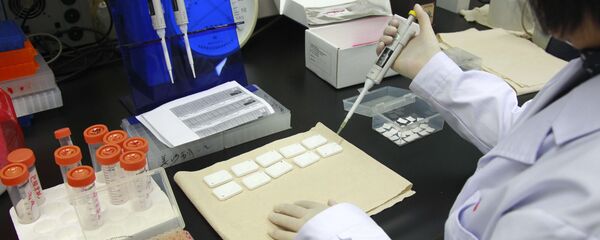 AIDS-HIV - Sputnik Türkiye