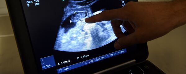 Ultrason - Sputnik Türkiye