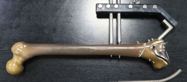 Kırık tedavileri için 'yerli çivi' üretildi Kırık tedavileri için 'yerli çivi' üretildi - Sputnik Türkiye