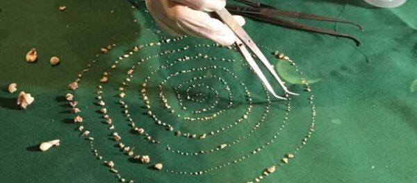 Hindistan'da diş anormalisi - Sputnik Türkiye