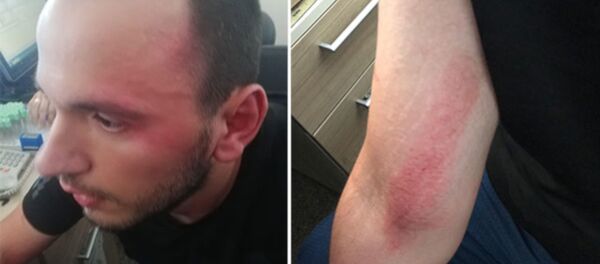 Özel harekat polislerinden doktora şiddet iddiası - Sputnik Türkiye